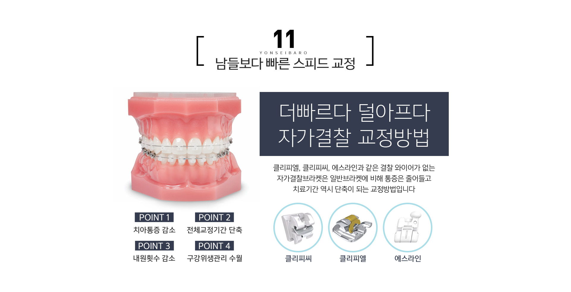 남들보다 빠른 스피드 교정 / 더 빠르다! 덜 아프다! 자가결찰 교정방법