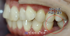 치료 전 ③