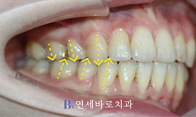 치료 후 ①