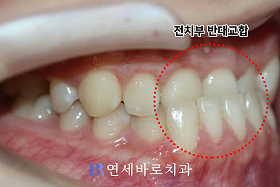 치료 전 ②