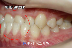 치료 전 ③