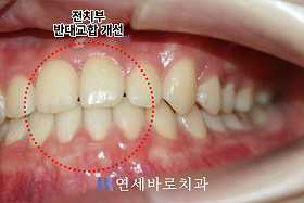치료 후 ③