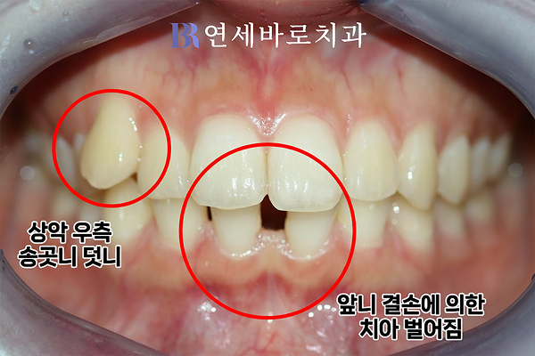 초진 정면 구내 사진