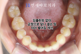 치료 후 ⑤