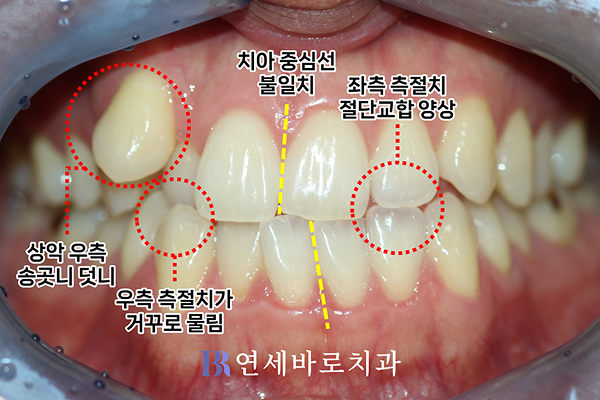초진 정면 구내 사진