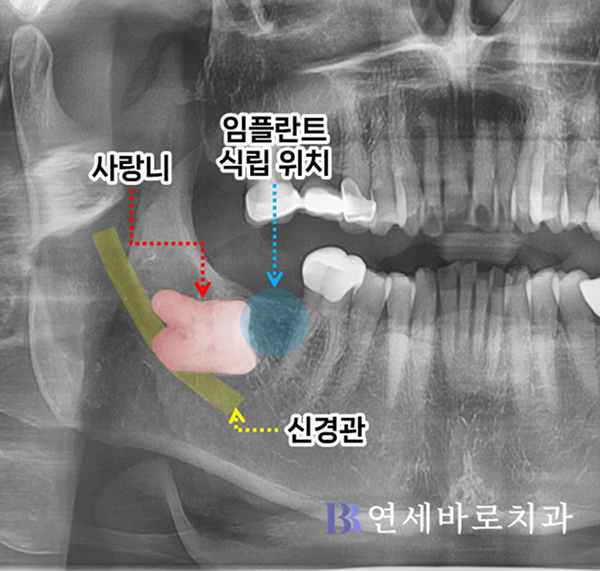 초진 파노라마