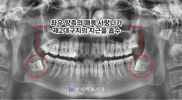 초진 파노라마