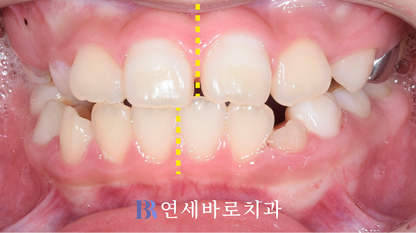 초진 정면 구내 사진