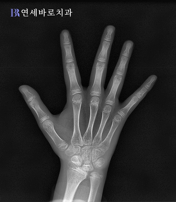 수완부 엑스레이