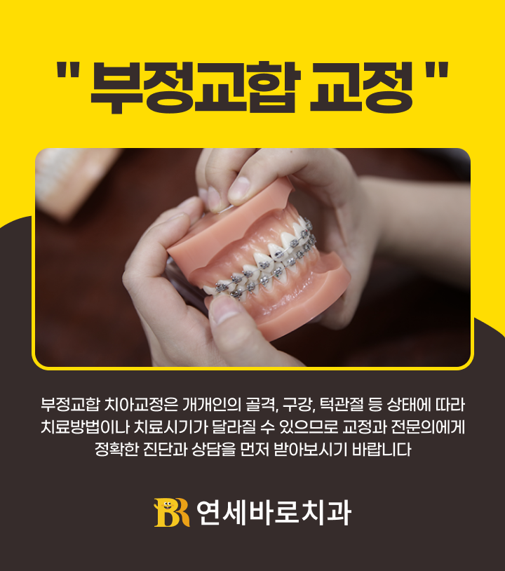 부정교합 치아교정 정확한 진단과 상담
