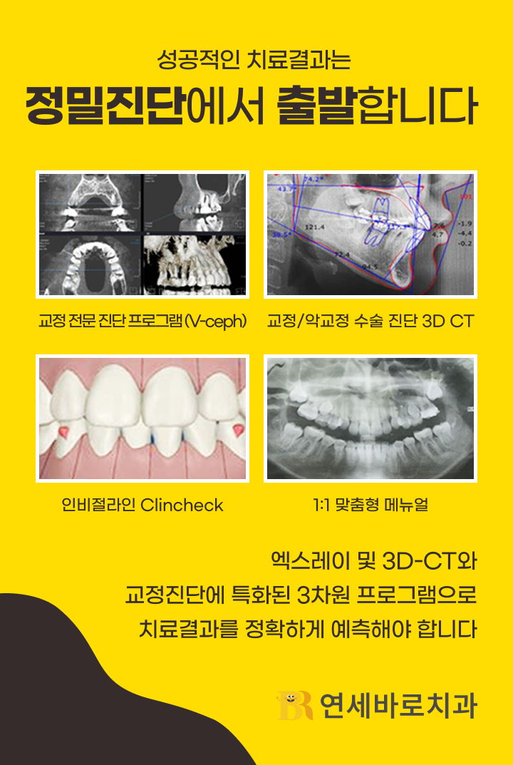 성공적인 치료결과는 정밀진단에서 출발 교정 진단